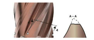 End‑mill Tool Wears’ 11 Types in Milling Operations 4